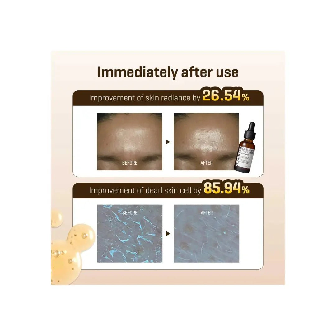 Some By Mi Galactomyces Pure Vitamin C Glow Serum 30ml brightening and radiance boosting skincare serum